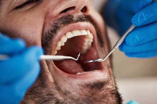 Best Emergency Treatment for Toothache in Colfax, WA